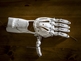 3D-Druck einer Handprothese